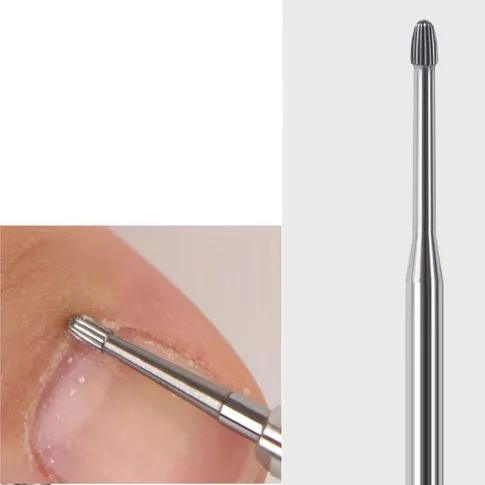 Remove Dead Skin Small Round V Bit